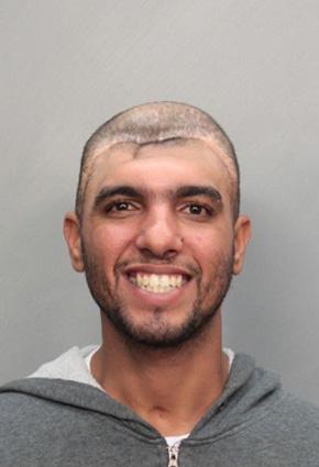 الرجل ذو النصف رأس ... "المخدرات هي السبب"